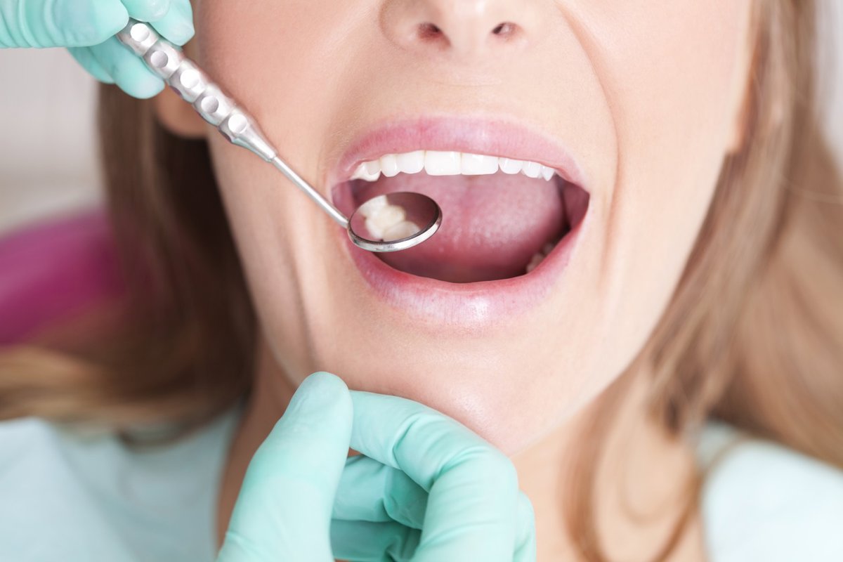 pelos podrían ayudar a regenerar dientes en un avance sorprendente contra las caries
