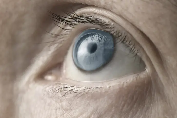 Melanoma uveal: definición y formas de prevención del cáncer ocular