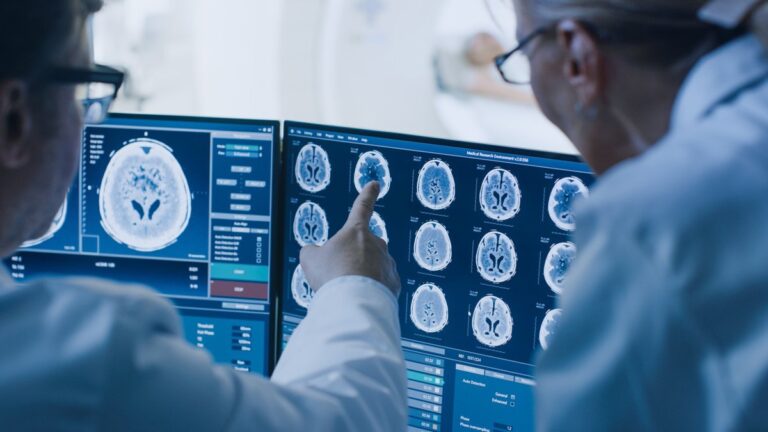Niveles de hierro en el cerebro podrían prever el riesgo de Alzheimer antes de los primeros