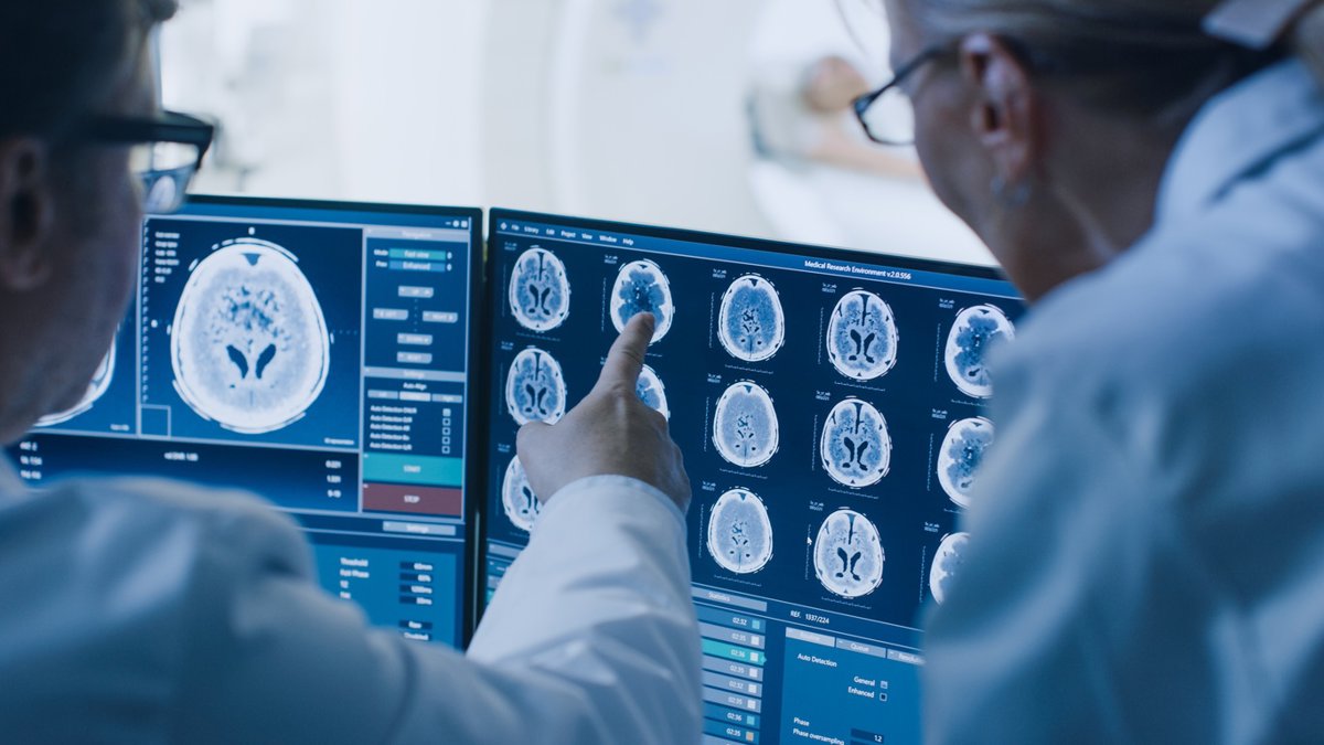 Niveles de hierro en el cerebro podrían prever el riesgo de Alzheimer antes de los primeros