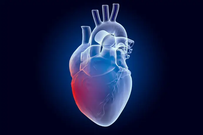 ¿Además de la placa arterial, qué factores provocan ataques cardíacos en jóvenes adultos?