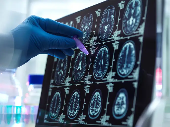 La mayoría de los expertos considera que la escasez de tiempo afecta el diagnóstico precoz del