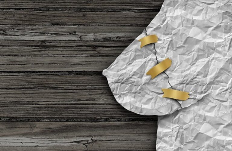 Cómo la mastectomía impacta tu cuerpo y tus emociones