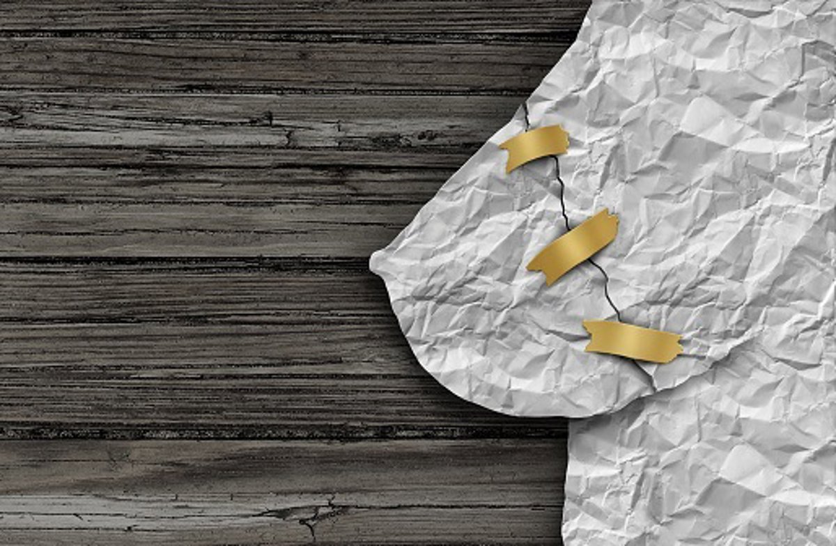 Cómo la mastectomía impacta tu cuerpo y tus emociones