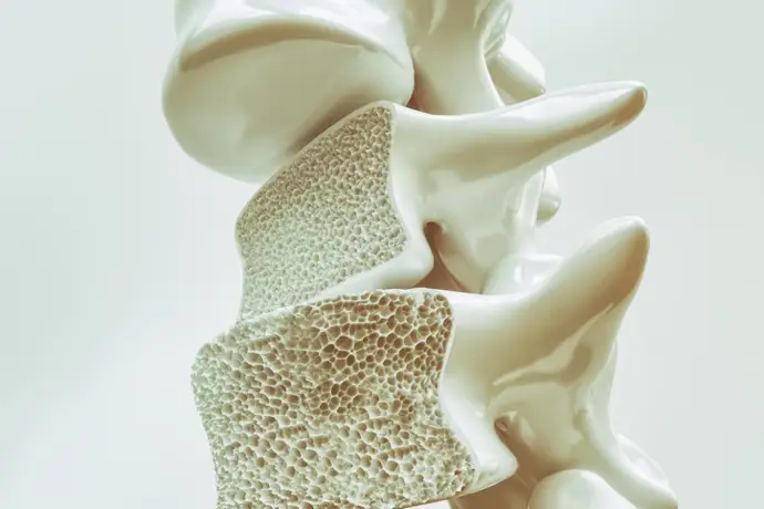 En España hay tres millones de personas con osteoporosis y se espera que esta cifra aumente
