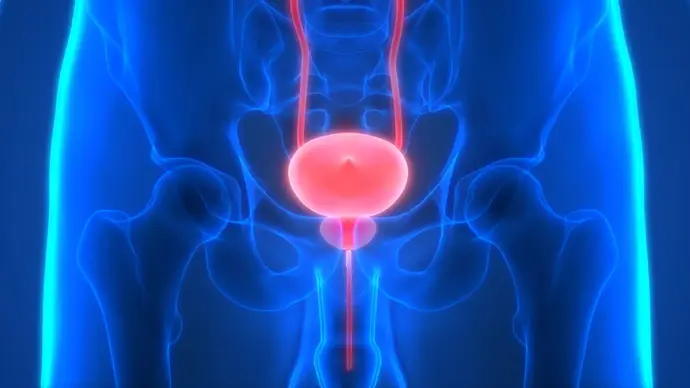 Nueva combinación de medicamentos disminuye la mortalidad en cáncer de próstata recurrente en un