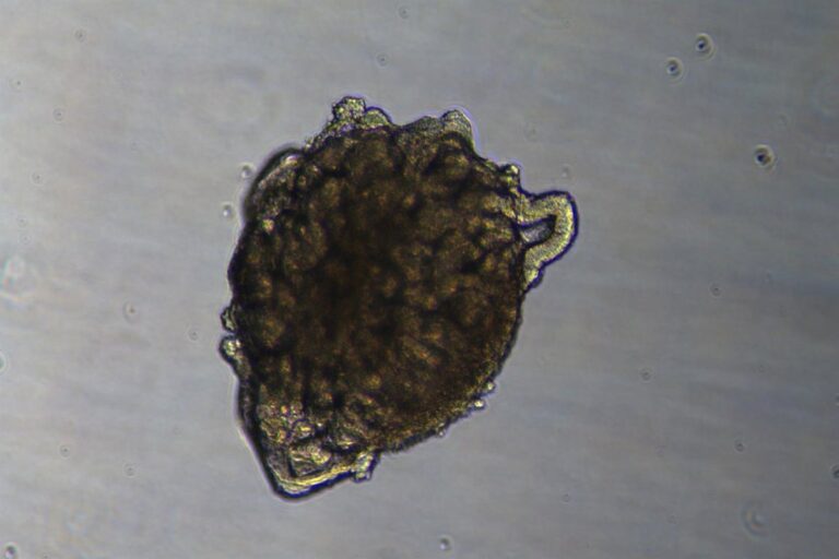 Realizan un trasplante en un cerdo de riñones modificados con organoides humanos