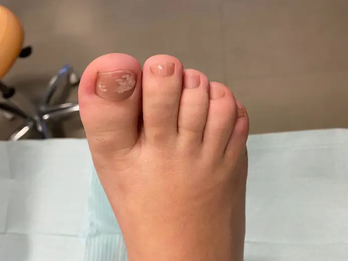 ¿Y si el desagradable olor a huevo podrido tuviera propiedades curativas para tus uñas?