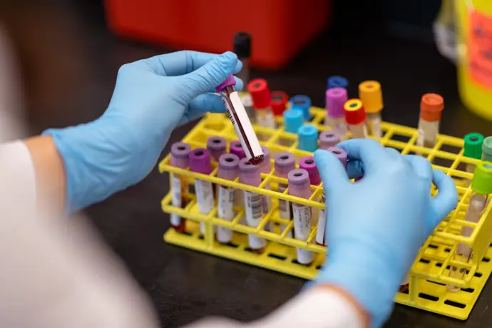 Un análisis de sangre podría identificar el cáncer en sus primeras etapas y aumentar la