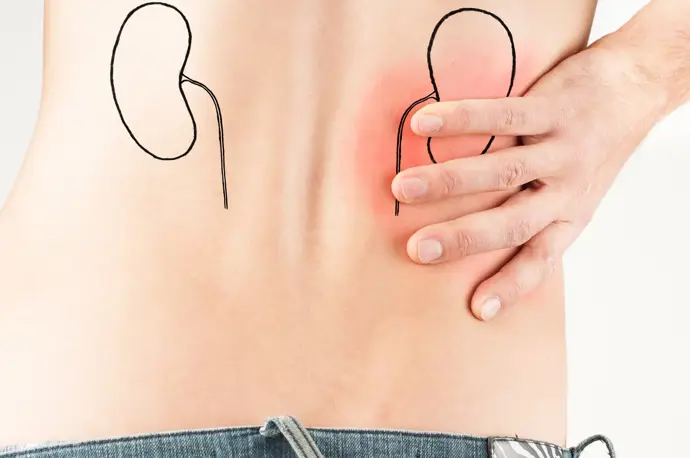 La enfermedad renal crónica aumenta: cerca de 800 millones de personas la sufren en el mundo