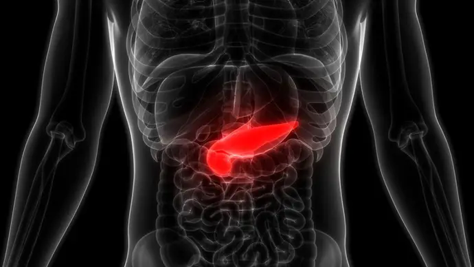 Cáncer de páncreas: el aumento alarmante y los síntomas silenciosos que muchos ignoran