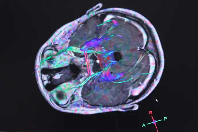 Descubren vínculo entre trastornos cerebrales y intestinales que podría facilitar la detección