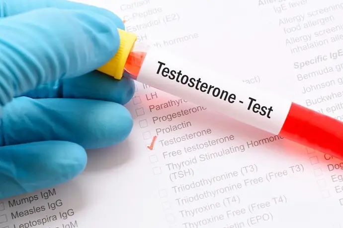 Cuándo es recomendable comenzar la terapia de testosterona según un urólogo
