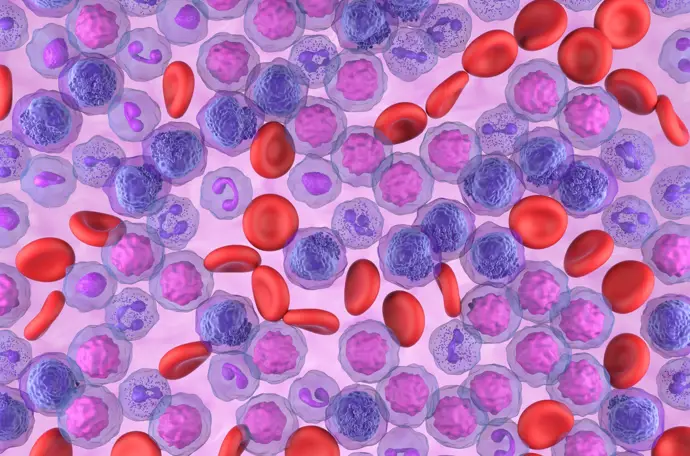 Una nueva combinación de fármacos podría superar la resistencia en leucemia mieloide aguda