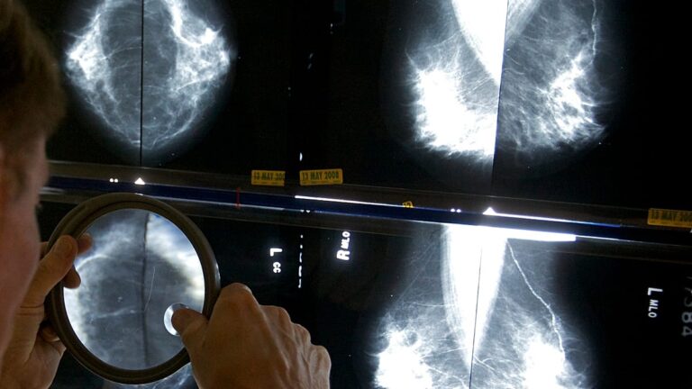 Dos pacientes oncológicos mueren en Burgos por un error humano en su tratamiento médico