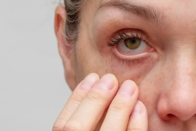 Invierno y salud ocular: consejos para cuidar tus ojos del frío intenso