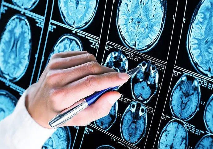 AHNAK podría ser fundamental para frenar la progresión del Alzheimer según investigaciones