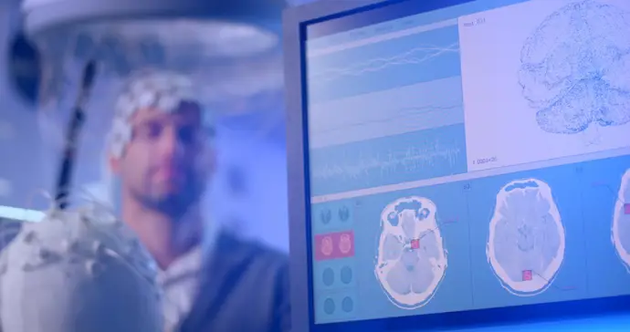 Eliminar células envejecidas podría ayudar a frenar la epilepsia del lóbulo temporal