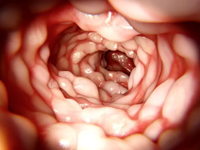 Investigadores desarrollan un implante para reducir la inflamación en enfermedades intestinales