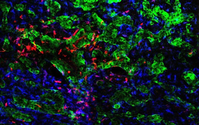 Archivo - El CNIO identifica cómo las células tumorales reprograman el cerebro para favorecer la metástasis