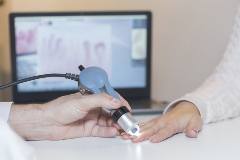 Investigación revela las diferencias de esclerodermia entre hombres y mujeres