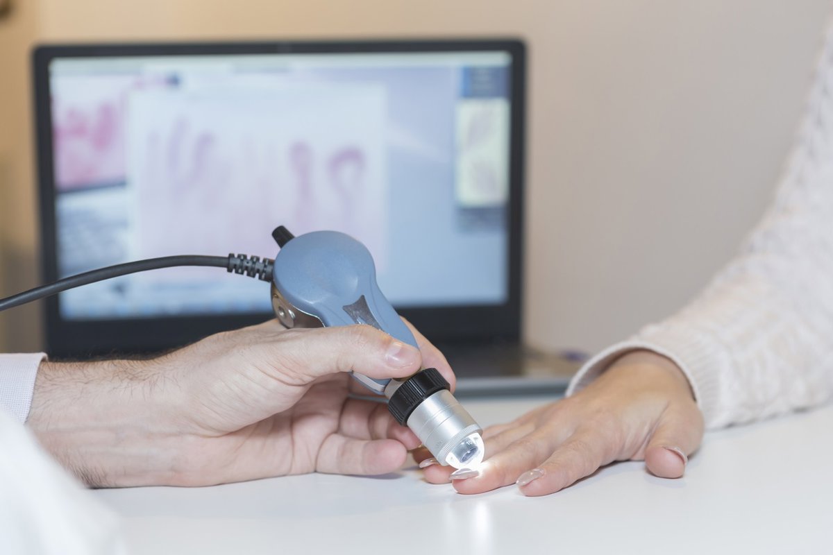Investigación revela las diferencias de esclerodermia entre hombres y mujeres