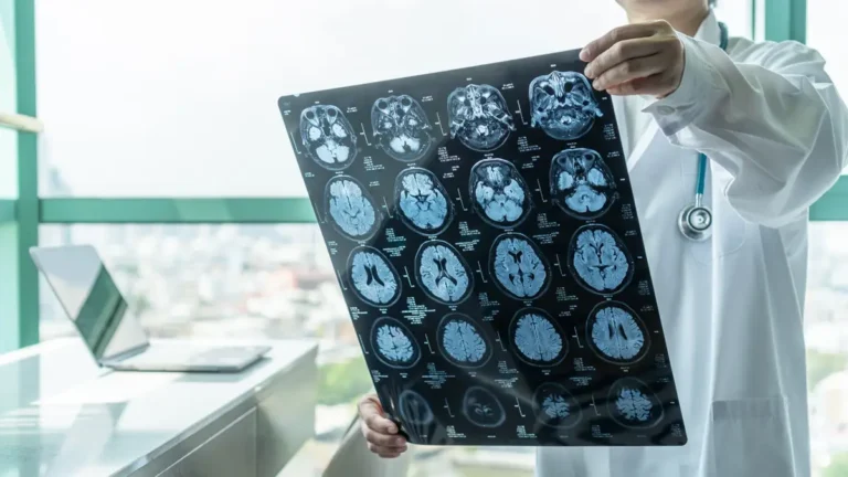 CEAAF denuncia demoras de 572 días para diagnosticar Alzheimer y desigualdades en la atención