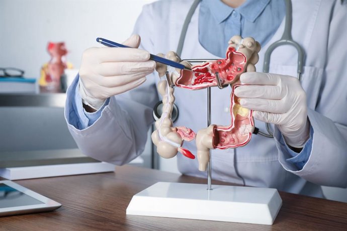Archivo - Imagen de recurso de un modelo de colon humano.